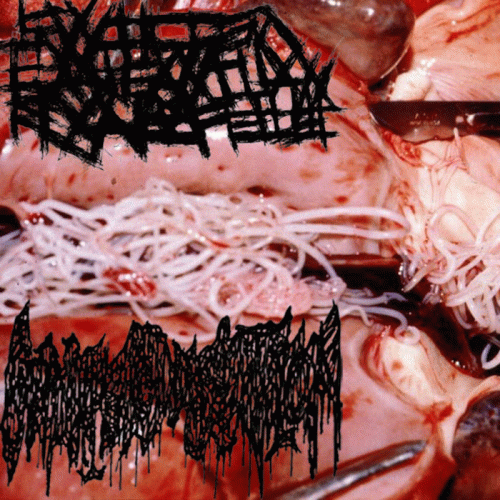 Coprophilic Dissection : Coprophilic Dissection - Swollen Gargantuan Fecal Fetus Coprophilic Dissection : Coprophilic Dissection - Swollen Gargantuan Fecal Fetus